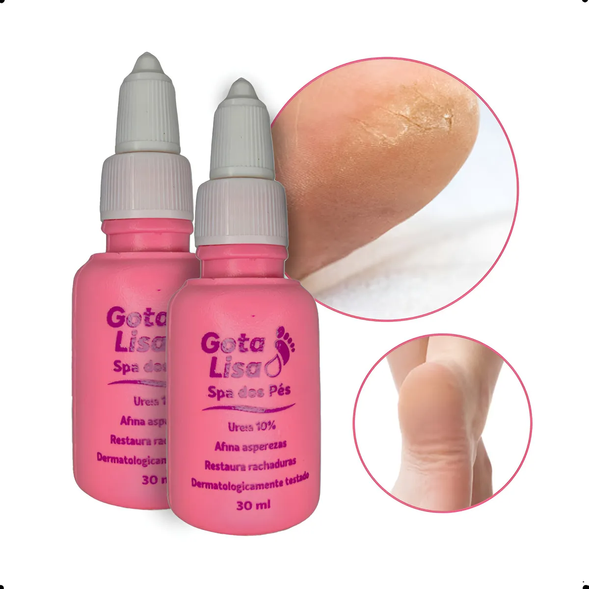GOTA LISA 30ML ACEMAR