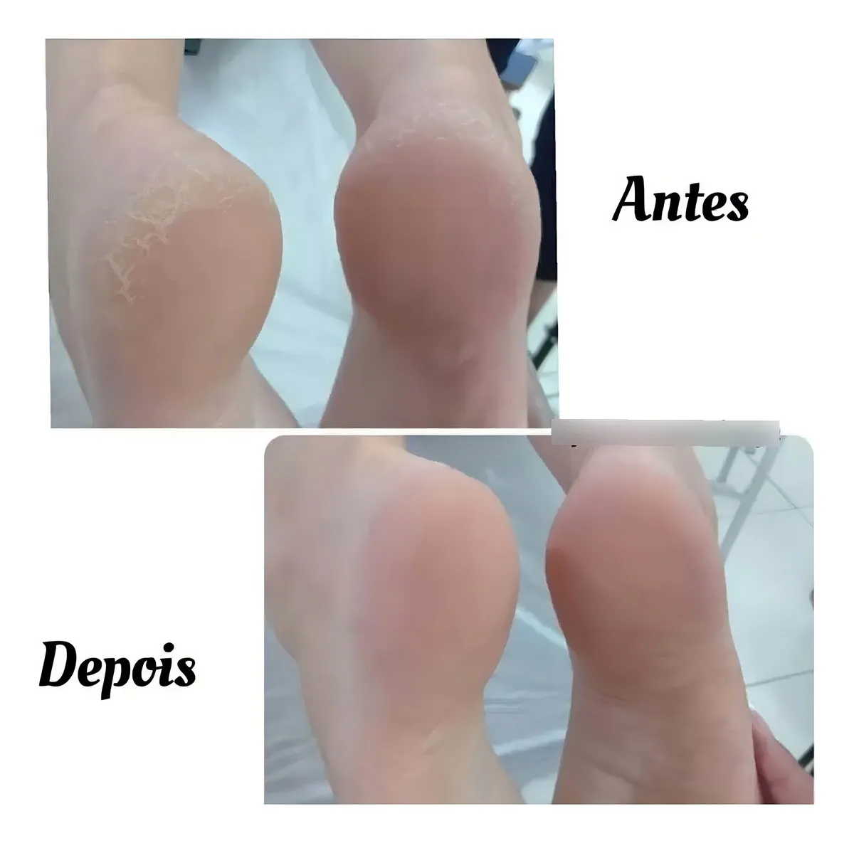 AMACIANTE DE CUTICULAS E CALOSIDADE REPOS 500ML - Imagem 2
